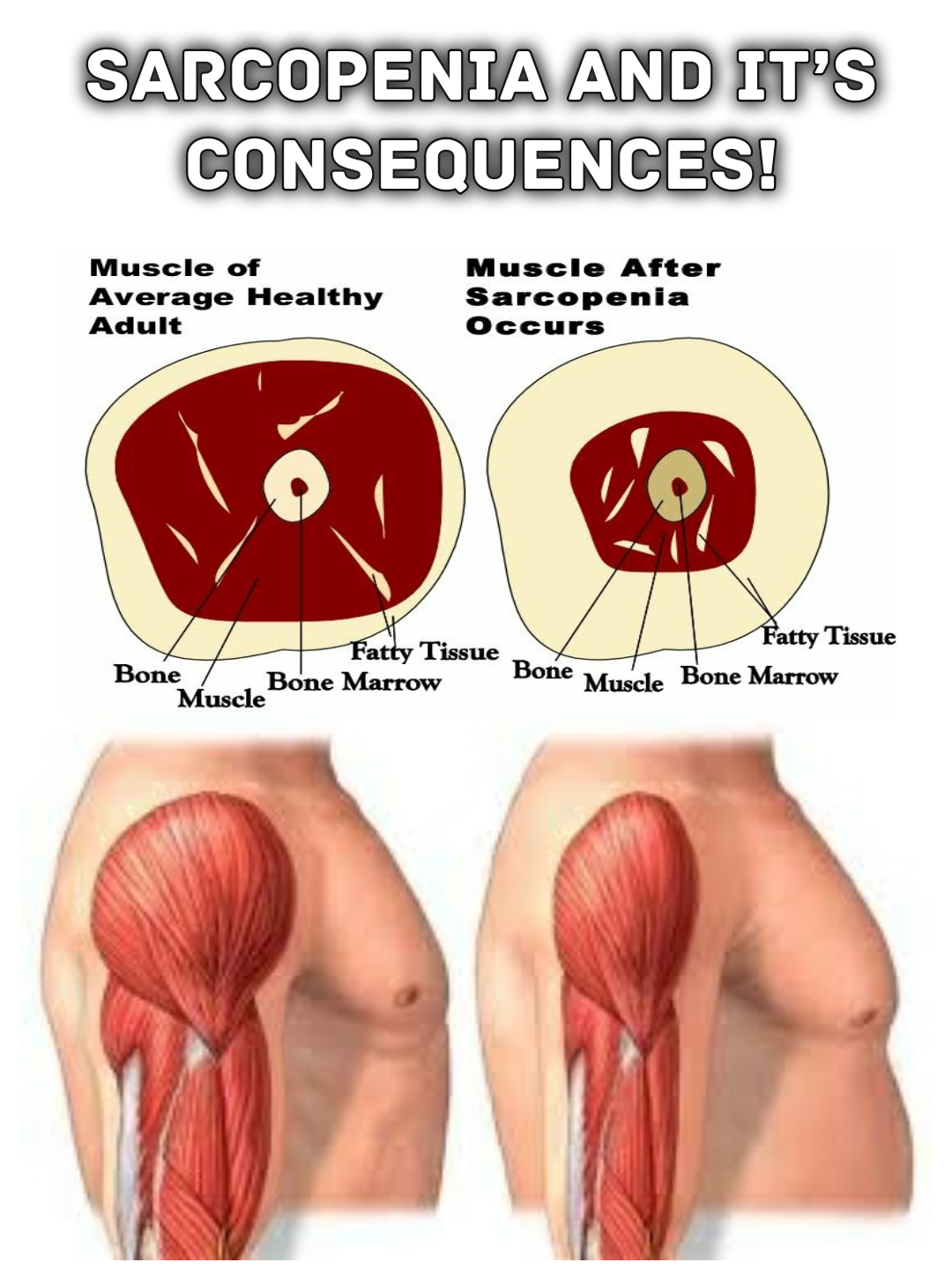 Sarcopenia Muscle Loss With Aging Fitnessology